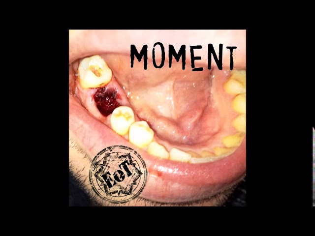 EoT predstavljaju novi singl – Moment